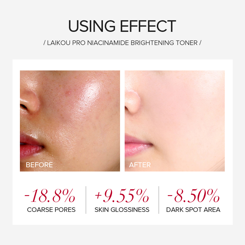 LAIKOU PRO Niacinamida, Set de - Korean Skincare Routine reseña y precio