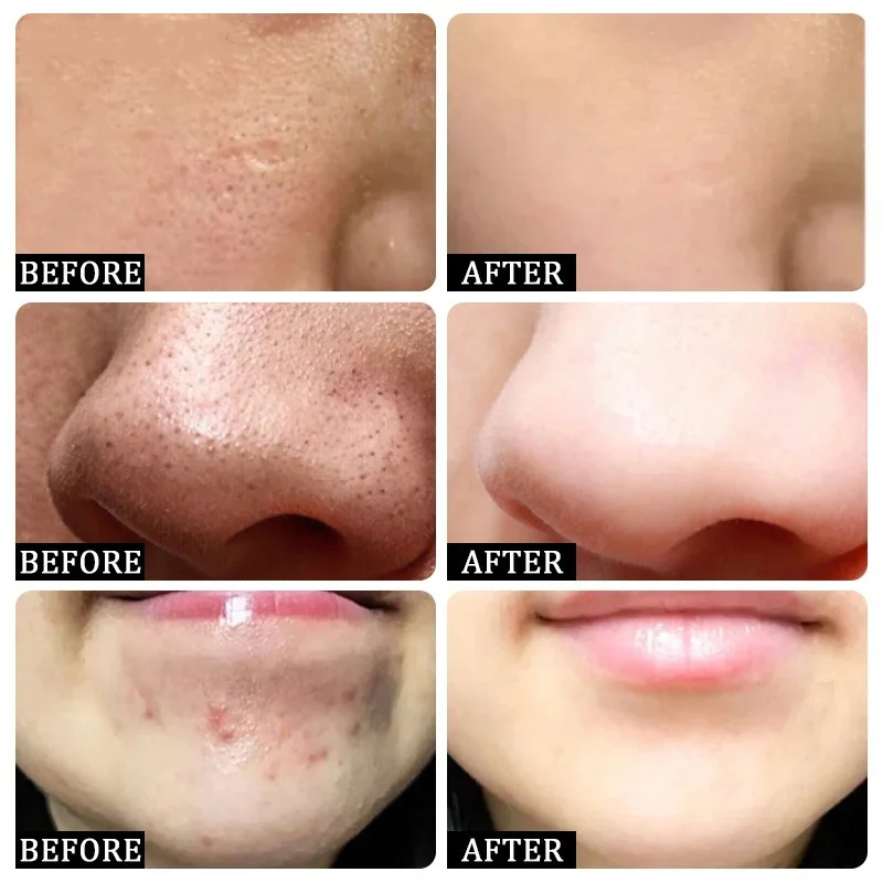 Crema limpiadora de poros de á - Korean Skincare Routine reseña y precio