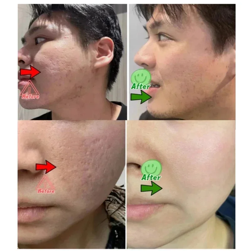 Crema limpiadora de poros de á - Korean Skincare Routine reseña y precio